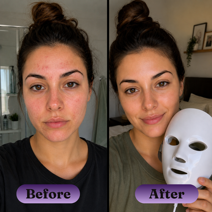 7-Color LED Facial Rejuvenation Mask